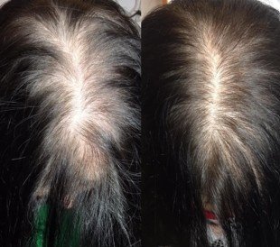 hair2-ErlinaKearse-LewisDrP